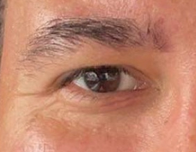beyond the iris